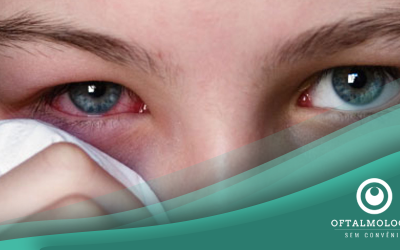 CONJUNTIVITE: MOTIVOS PARA FICAR DE OLHO NESTA DOENÇA
