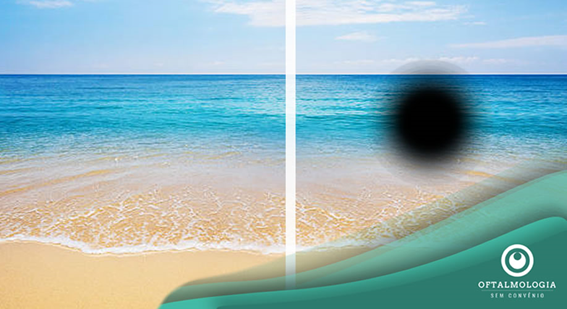 DEGENERAÇÃO MACULAR E ENVELHECIMENTO SAUDÁVEL